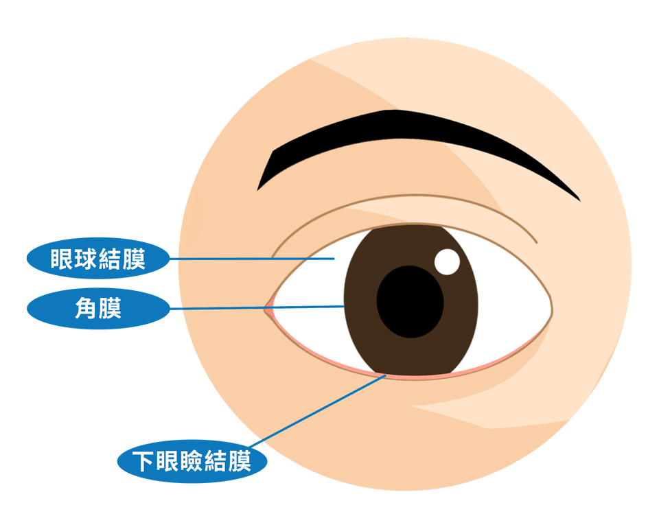 ecd_conjunctivitis_know